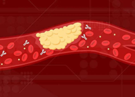 【Science速递】攻克COVID-19里程碑：已确定血凝块形成原因！