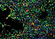 世界首创：药物将干细胞引导至受损部位，提高其愈合能力！
